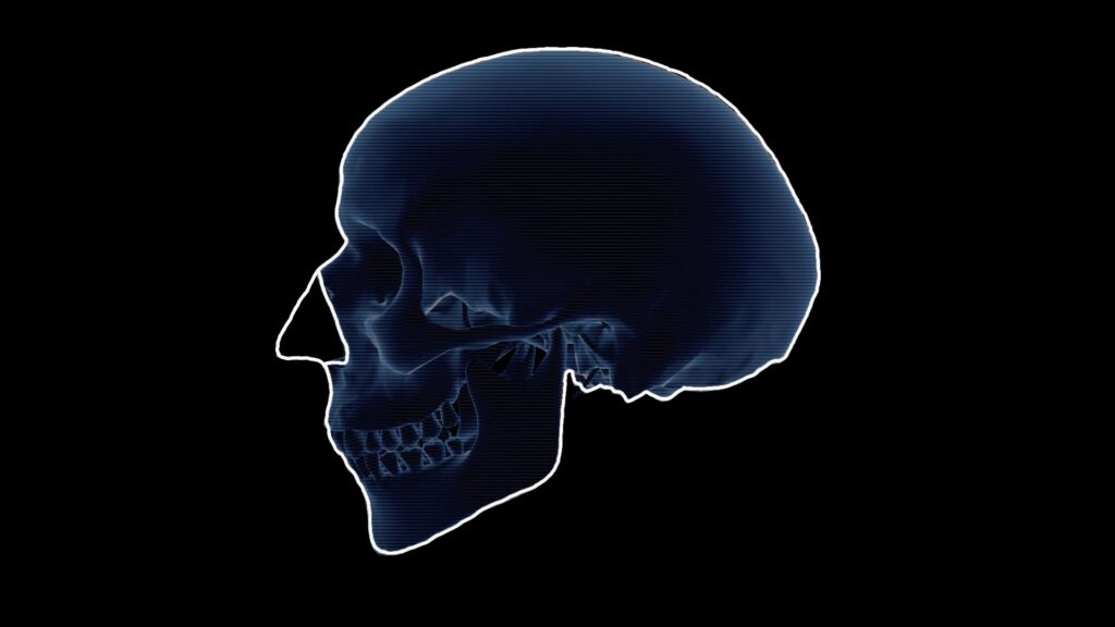View of reconstructed nose shape on the skull.