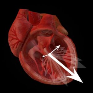 Cross-section of the heart showing a circular vectorcardiogram with three vectors from the beginning, middle, and end, each with different magnitudes and directions.